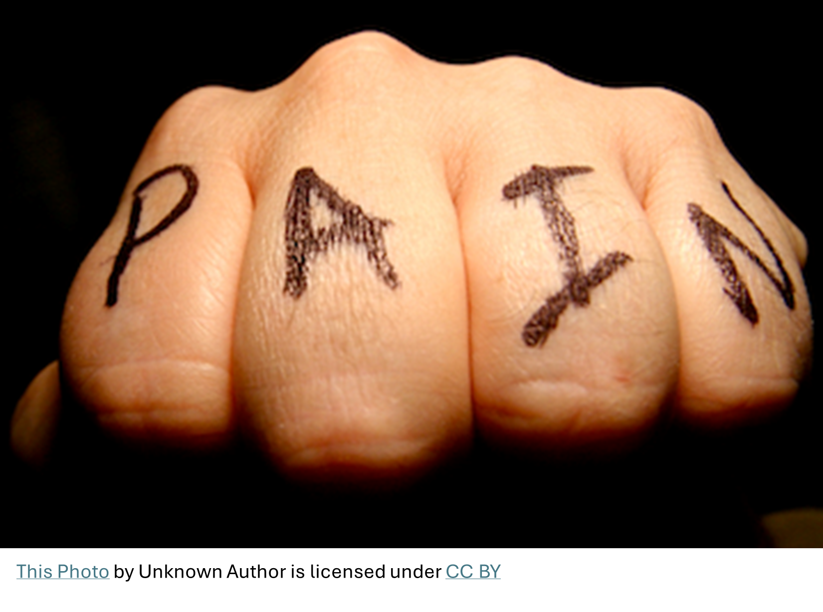 Psychological Treatment of Chronic Pain